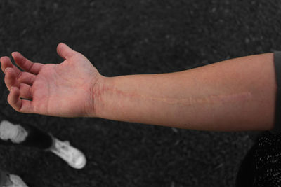 Cropped hand of person with scar on road