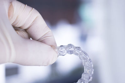 Close-up of person holding plastic braces