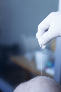 Close-up of hand holding acupuncture needle 