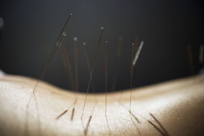Midsection of person with acupuncture needles on back against black background
