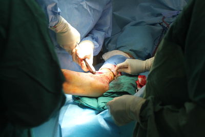 Ankle surgery 