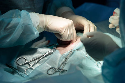 Veterinary surgery, operation, laparotomy concept. closeup of cesarean section of cat