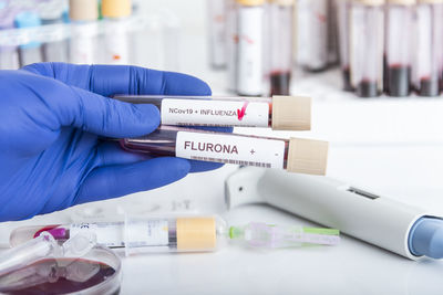 Cropped hand of scientist examining chemical in laboratory