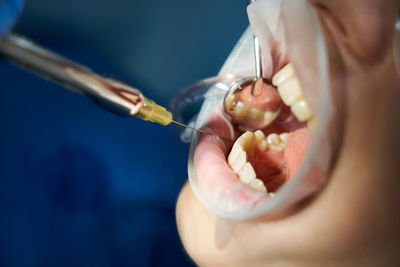 Woman getting dental treatment