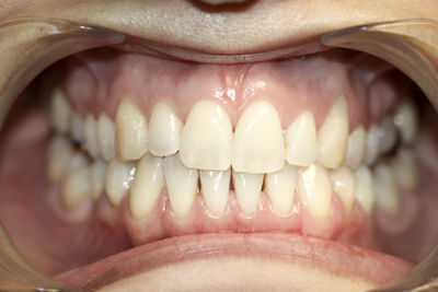 Close-up of human teeth