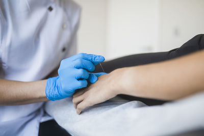 Cropped unrecognizable skilled female physiotherapist in medical uniform and gloves treating hand of patient with needle during acupuncture therapy session