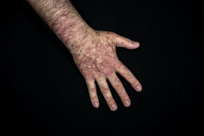 Close-up of human hand against black background