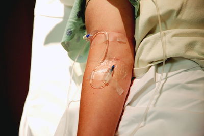 Cropped image of woman hand with iv drip at hospital