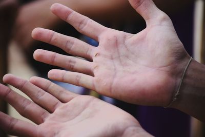 Close-up of person with injured hands