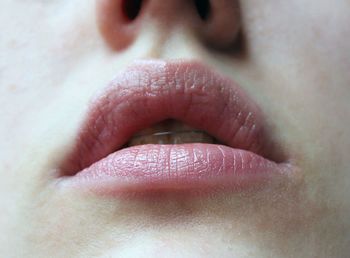 Close-up of lip