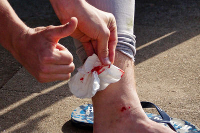 Cropped image of man with injured ankle gesturing thumbs up sign