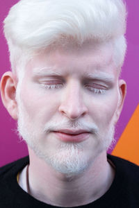 Portrait of an albino man with eyes closed