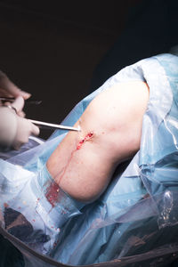 Cropped hands of surgeons doing knee surgery in hospital