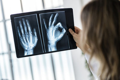 Female doctor examining x-ray of hand at medical clinic