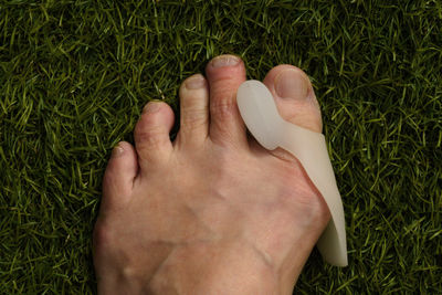 Silicone bunion regulator bunion on left foot of an adult white woman on astro turf. 
 