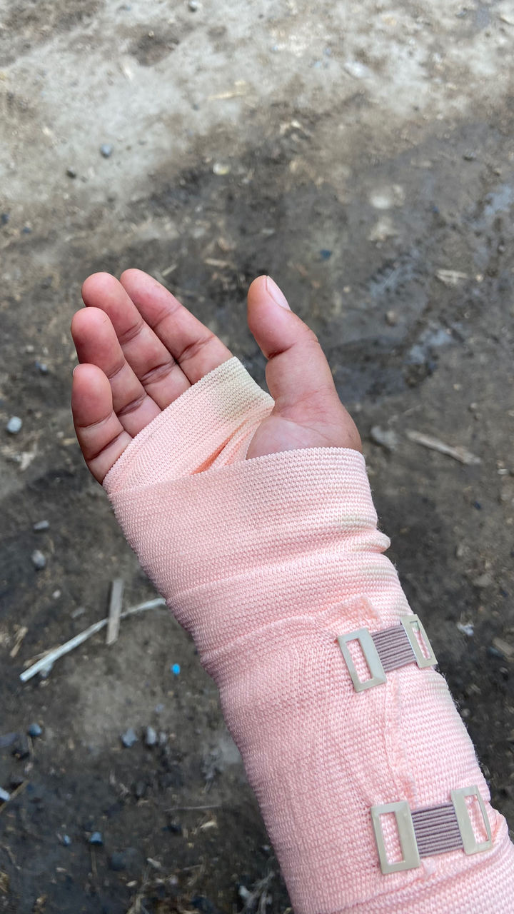 human leg, hand, finger, limb, bandage, one person, pink, physical injury, medical supplies, arm, healthcare and medicine, high angle view, close-up, misfortune, day, fracture, human limb, pain