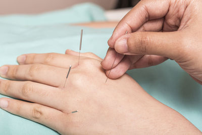 Cropped image of person doing acupuncture