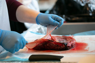 Person with close pulling apart amniotic sac from placenta.