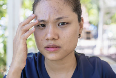Young asian woman worry about her face when she has problems with skin on her face in a natural.