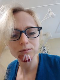 Headshot of woman with stitches on injured chin at hospital