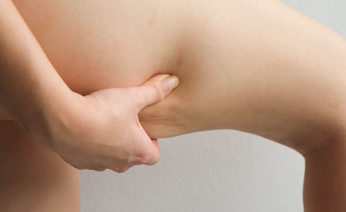 Cropped image of woman pinching thigh