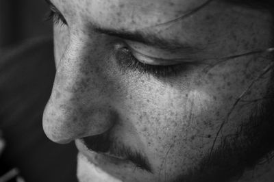 Close-up of man with freckles