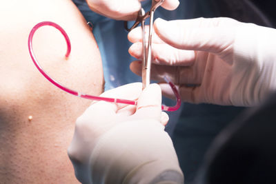 Cropped hand of doctor holding scissors and pipe while performing surgery