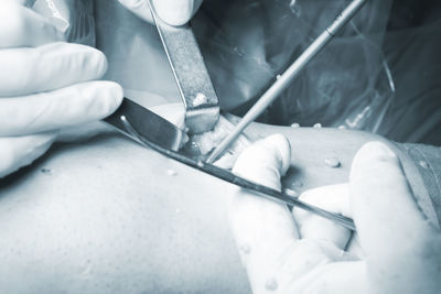 Cropped hands of surgeons doing patient surgery in hospital