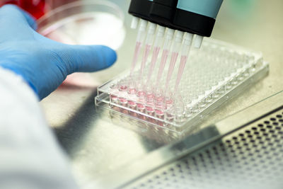 Cropped hand of scientist working in laboratory