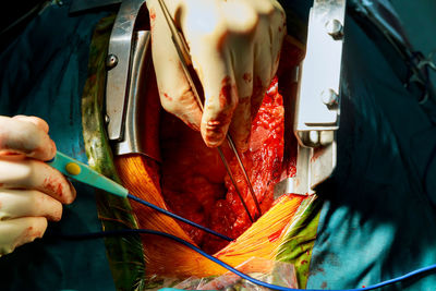 Cropped hands of doctor operating patient in hospital