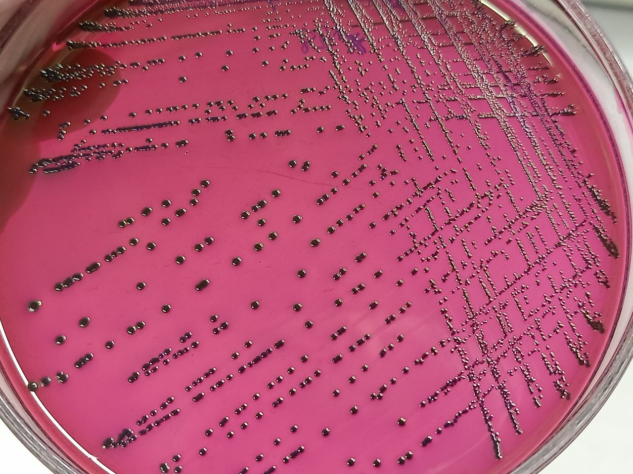 pink, purple, biology, education, science, circle, human eye, indoors, magenta, research, healthcare and medicine, scientific experiment, microbiology, violet, petri dish, biochemistry, close-up, magnification