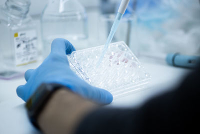 Cropped hand of scientist examining chemical in laboratory