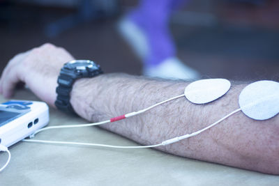 Cropped hand of patient with electrodes on forearm