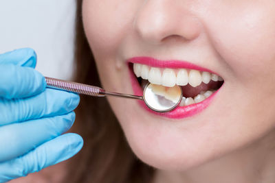 Close-up of dentist examining patient teeth