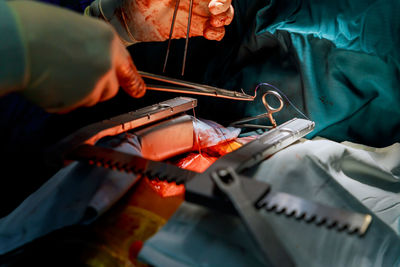 Cropped hands of doctor operating patient in hospital