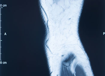 Close-up of human hand against black background