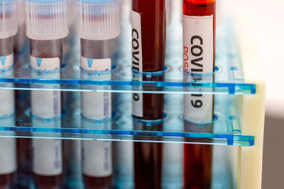 Close-up of blood samples on table in laboratory