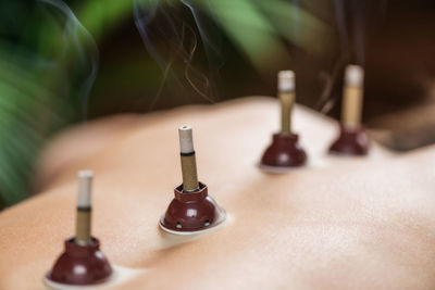 Mugwort moxibustion back therapy. burning moxa stick placed near acupuncture point 