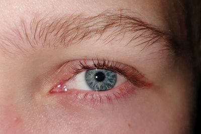 Close-up of boy with gray eye