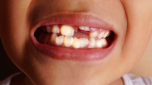 Close-up of boy with gap teeth