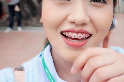 Cropped image of happy woman wearing braces