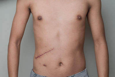 Midsection of shirtless man with wound standing against gray background