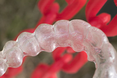 Close-up of braces