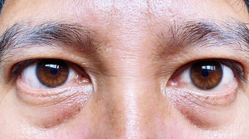 eyebrow