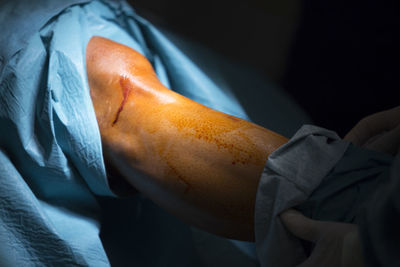 Cropped hand of doctor cleaning patient leg with napkin in hospital