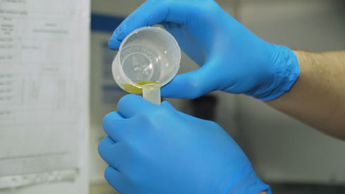 Close-up of hand of doctor holding urine sample