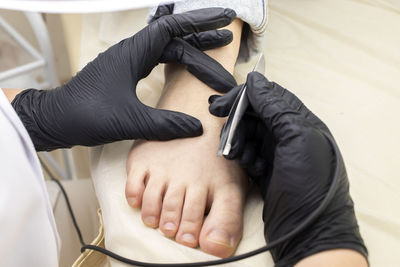 Cropped dermatologist doing hair removal electrolysis procedure on woman's toes, foot. electric
