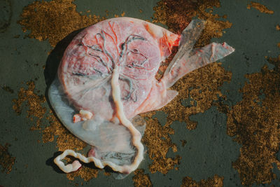 Placenta of human 
