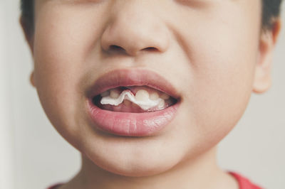 Close-up of young boy with missing tooth