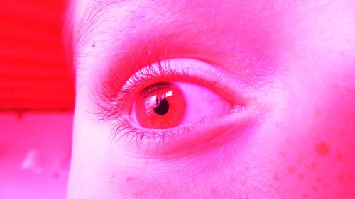 Close-up of woman with pink eyes